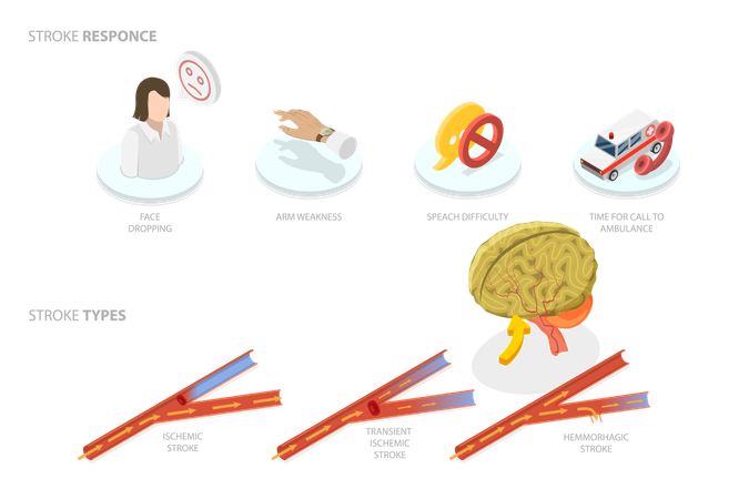Brain Blood Supply Problem  Illustration