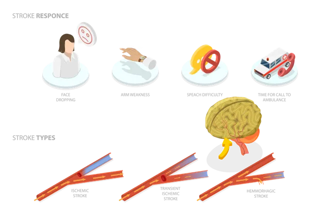 Brain Blood Supply Problem  Illustration