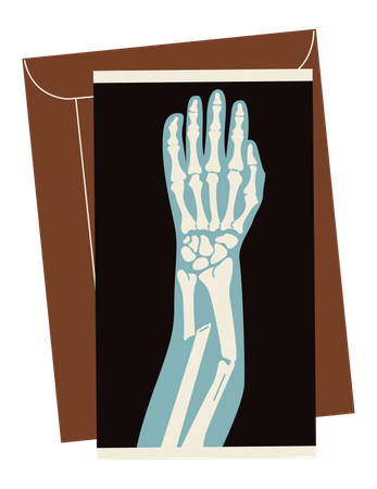 Radiographie du bras cassé  Illustration