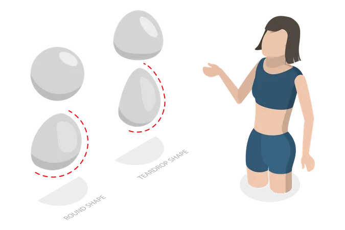 3 D Isometric Flat Vector Conceptual Illustration Of Breast Implant Types Cosmetic Surgery イラスト