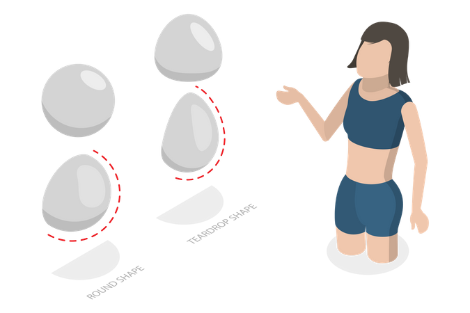 Breast Implant Types  Illustration