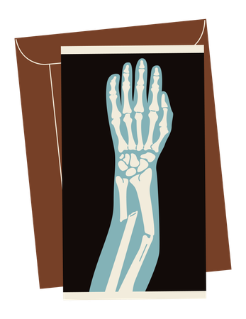 Broken arm x-ray  Illustration