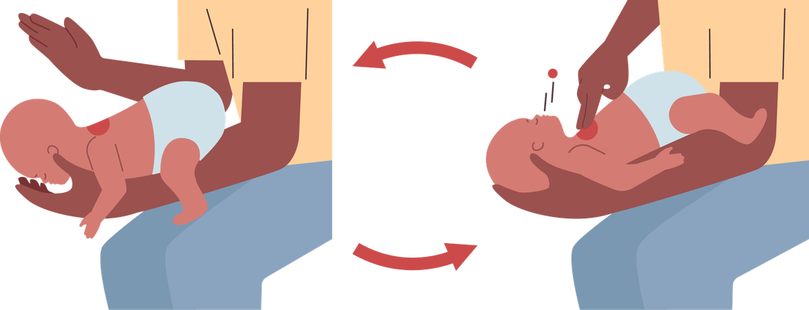 Choking first aid. Heimlich maneuver procedure to remove a foreign  Illustration
