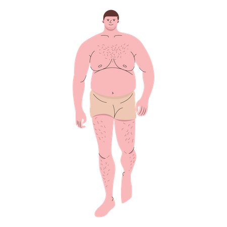 Chubby man wearing boxer shorts walking  Illustration