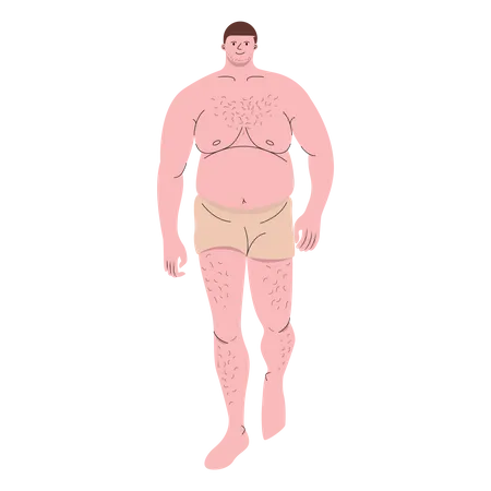 Chubby Man Wearing Boxer Shorts Walking Vector Illustration In Flat Color Design Illustration