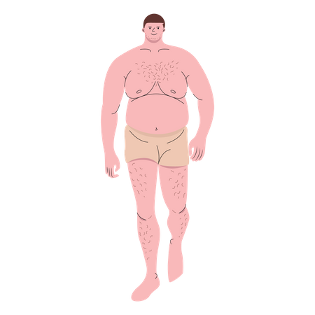 Chubby man wearing boxer shorts walking  Illustration