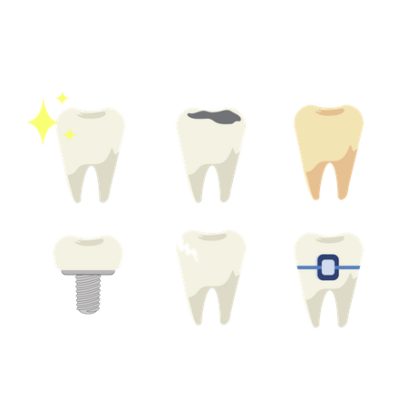 Conjunto de dientes con diferentes tipos de enfermedades dentales.  Ilustración