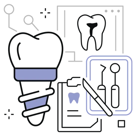 Dental implant  Illustration