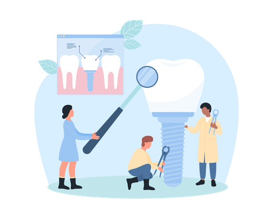 Dental implant  Illustration