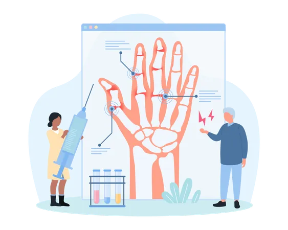 Diagnosis And Treatment Of Arthritis Vector Illustration Cartoon Tiny Doctor Examining Infographic Xray Of Old Patients Hand With Osteoarthritis Stiffness And Finger Joint Pain For Treatment Illustration