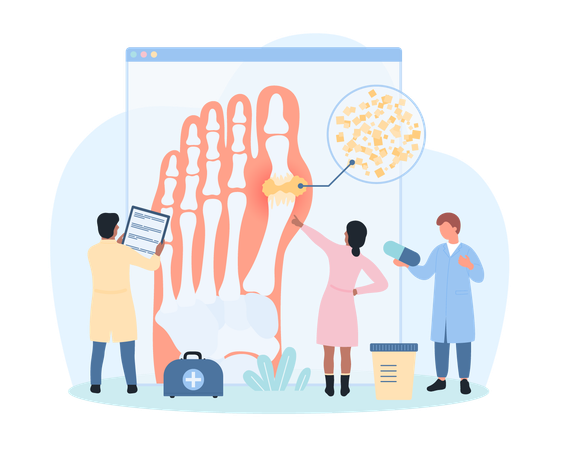 Diagnosis of gout  Illustration