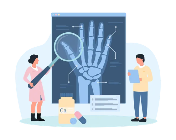 Diagnosis Of Osteoarthritis Rheumatoid Arthritis Using Radiography Vector Illustration Cartoon Tiny People Holding Magnifying Glass To Examine Xray Of Human Wrist Bones On Medical Exam In Hospital Illustration