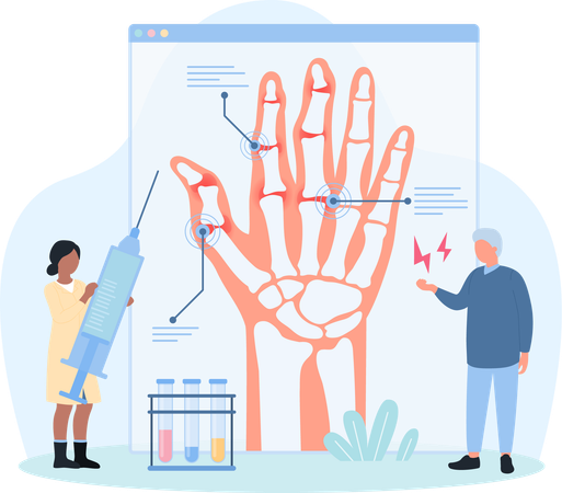 Diagnosis of osteoarthritis  Illustration