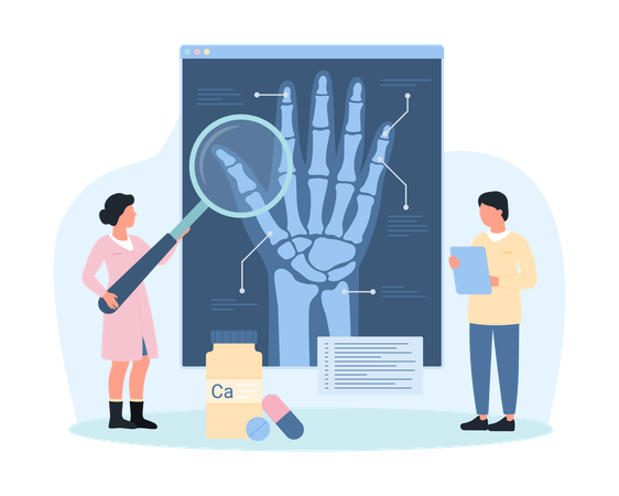 Diagnosis of osteoarthritis  Illustration