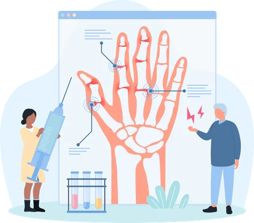 Diagnóstico de osteoartrite  Ilustração