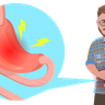 digestive tract problems illustration free download