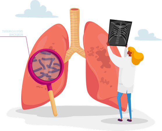 Doctor Holding X-ray Image of Lungs Learning Patient Fluorography with Tuberculosis or Pneumonia Disease  Illustration