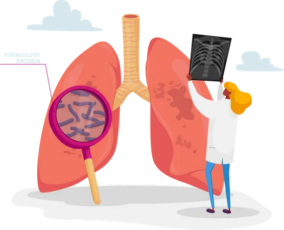 Doctor Holding X-ray Image of Lungs Learning Patient Fluorography with Tuberculosis or Pneumonia Disease  Illustration