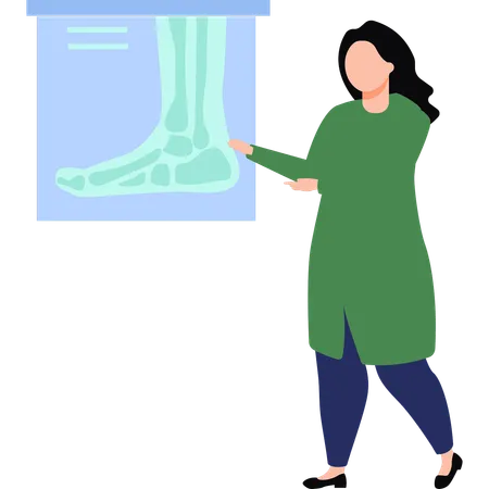 Doctor is showing the x-ray of foot  Illustration