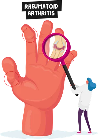Rheumatoid Arthritis Healthcare Concept Tiny Doctor Character Looking On Huge Hand With Inflamed Finger Joints Through Magnifying Glass Medical Check Up In Hospital Cartoon Vector Illustration Illustration