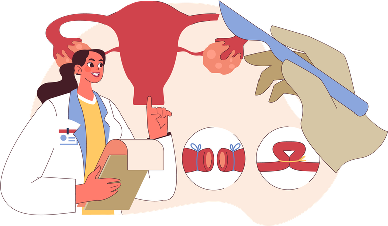 Doctor undertakes ovary surgery  Illustration