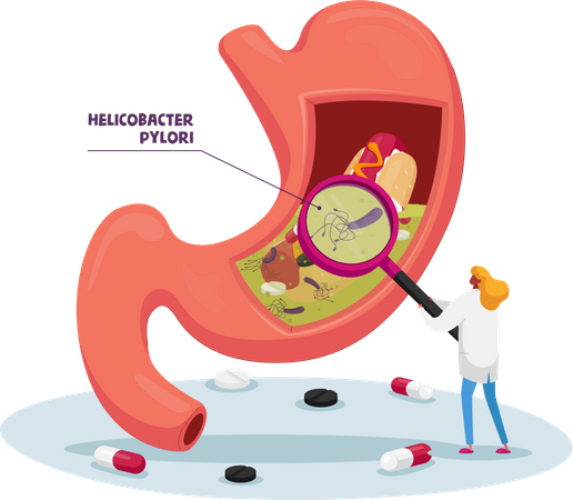 Doctor with Magnifying Glass Learning Sick Stomach with Helicobacter Pylori Disease or Gastritis  Illustration