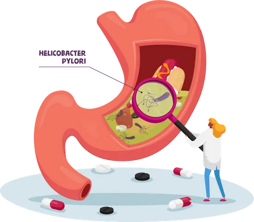 Doctor with Magnifying Glass Learning Sick Stomach with Helicobacter Pylori Disease or Gastritis  Illustration