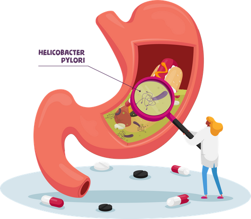 Doctor with Magnifying Glass Learning Sick Stomach with Helicobacter Pylori Disease or Gastritis Illustration