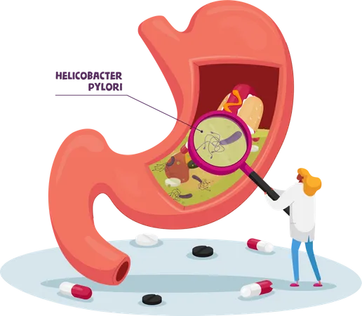 Doctor with Magnifying Glass Learning Sick Stomach with Helicobacter Pylori Disease or Gastritis Illustration
