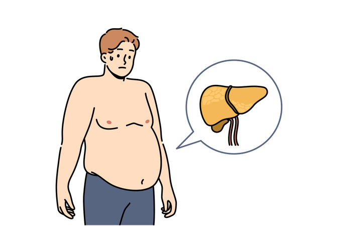 Doenças hepáticas em homens causam obesidade e problemas digestivos e sintomas de hepatose gordurosa  Ilustração