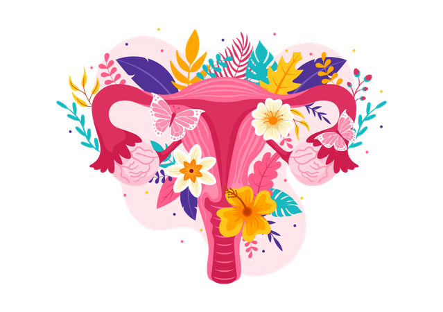 Endometriosis  Illustration