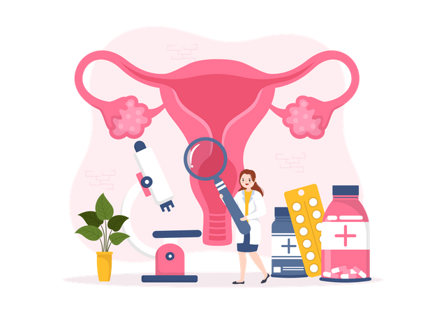 Endometriosis  Ilustración