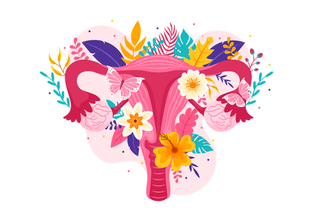 Endometriosis  일러스트레이션