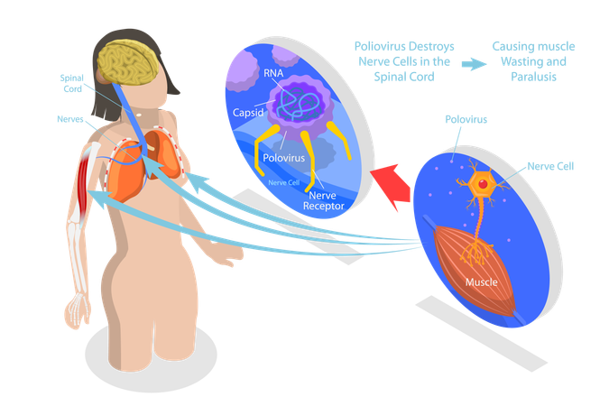 Esquema de explicação dos sintomas de infecção por vírus médico rotulado  Ilustração