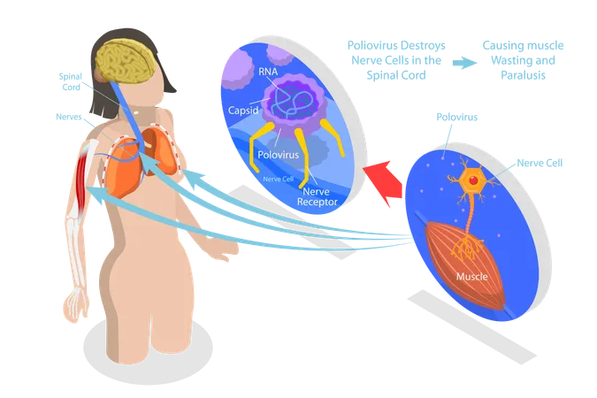 Esquema de explicação dos sintomas de infecção por vírus médico rotulado  Ilustração