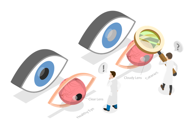Eye Surgery  Illustration