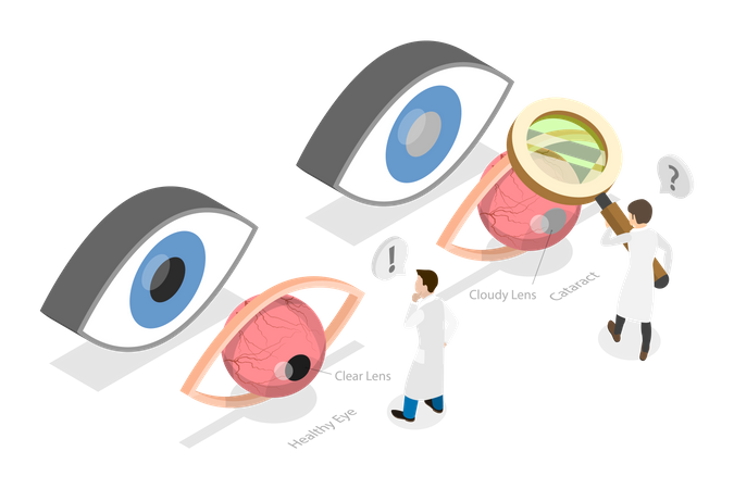 Eye Surgery  Illustration