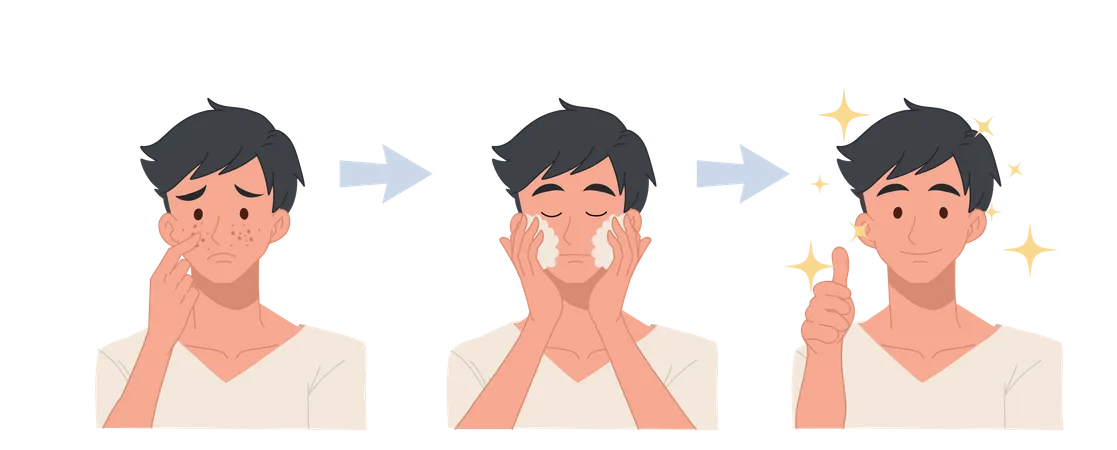 Facial procedure for acne treatment  Illustration