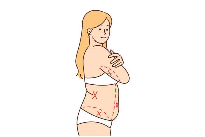 Fat woman without clothes with lines on body  Illustration