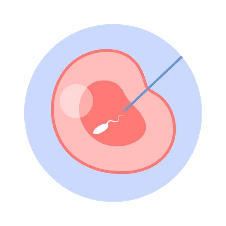 Fécondation artificielle de l'ovule de la femme  Illustration