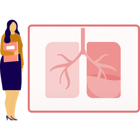 Female doctor checking lungs report  Illustration
