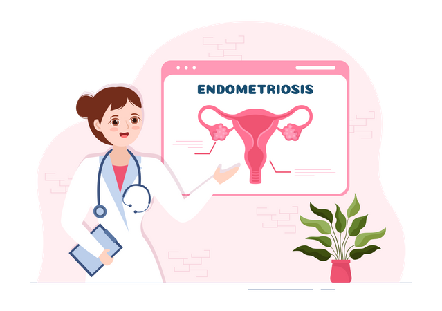 Female doctor explain Endometriosis  Illustration