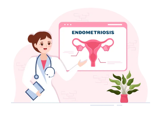 Female doctor explain Endometriosis Illustration