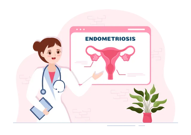 Female doctor explain Endometriosis  Illustration