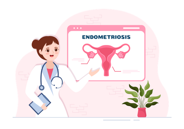 Female doctor explain Endometriosis  일러스트레이션