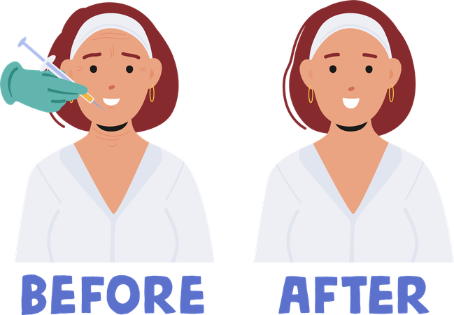 Female Face Before and After Beauty Injections  Illustration