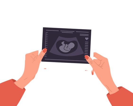 Female Hands Holding Fetus Sonography report  Illustration