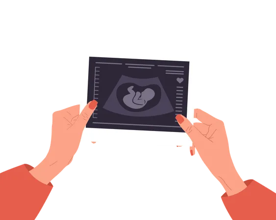 Female Hands Holding Fetus Sonography report  Illustration