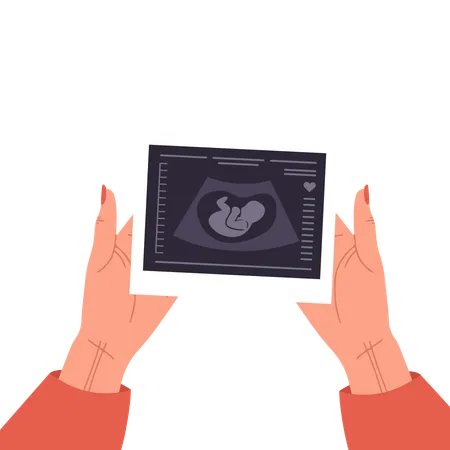 Female Hands Holding Fetus Sonography report  Illustration