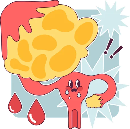 Female reproductive system  イラスト